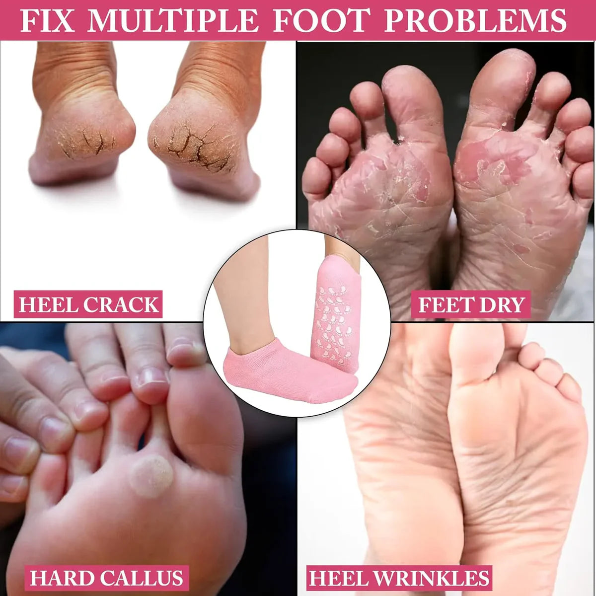 Crack Heal Silicon Spa Gel Socks for Women & Men - BUY 1 PAIR GET 1 PAIR FREE🤩